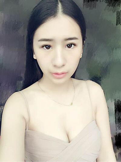 【双眼皮+丰下巴】对比照 瞬间变女神