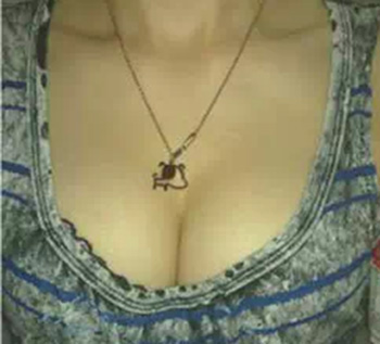 自体脂肪隆胸对比照 做性感女神