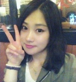 【磨骨瘦脸+垫鼻尖+眼部矫正】对比照 转身就是气质女神