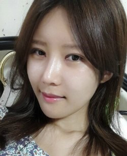 面部多项目整形对比照 改头换面成女神