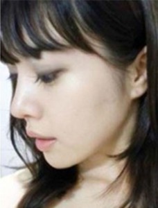 面部五官大改造 给你不一样的惊喜