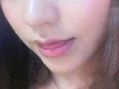 膨体丰下巴对比照 脸型更完美