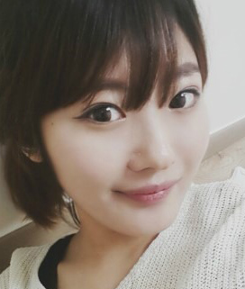 【埋线法双眼皮+开内眼角+外眼角下拉手术】对比照 瞬间女神范出