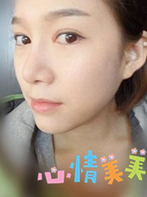 激光嫩肤 还白嫩的脸蛋