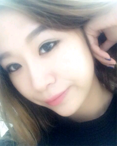 隆鼻  面部立体起来变侧颜美女