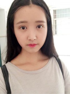 双眼皮手术 瞬间变小萌妹