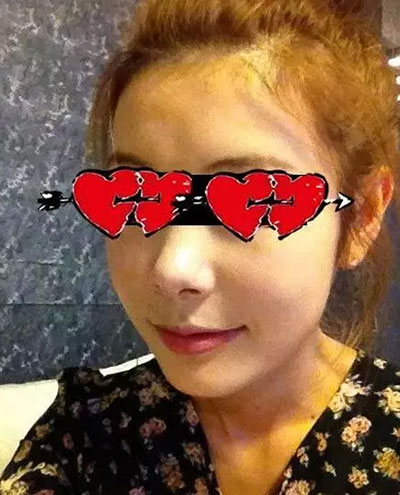 突嘴整形 自卑滚远远的美丽迎刃而上