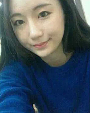 面部轮廓手术 让你拥有完美脸型 - 珍美网