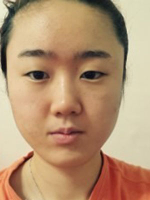 面部整形 逆袭成功变女神 - 珍美网