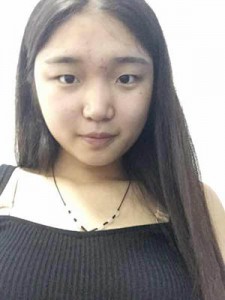 全切双眼皮 开启心灵之窗 - 珍美网