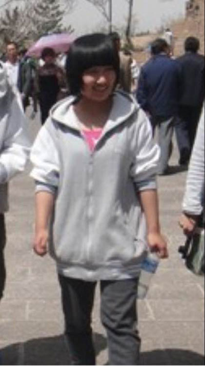 面部整形 逆袭的美让人羡慕 - 珍美网