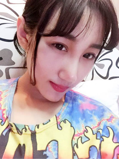 面部整形 逆袭的美让人羡慕