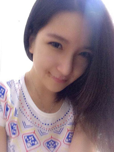 埋线法双眼皮+硅胶隆鼻 把自己变得完美