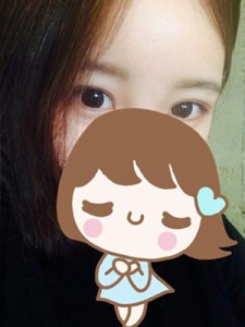 双眼皮手术+开眼角 让自己更加女人