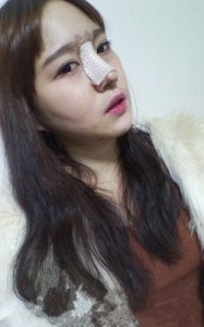 隆鼻手术 变成韩系甜美女生 - 珍美网