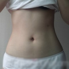 【大腿+腰部+ 屁股的吸脂整形】 性感苗条完美女人