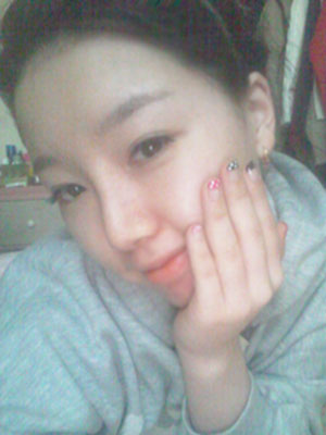 面部整形 给自己一个靓丽的青春