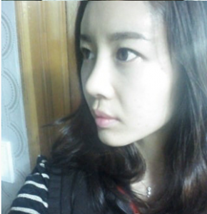 隆鼻手术 提升美丽翻倍