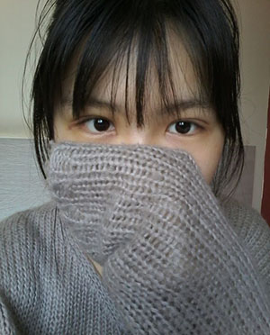 双眼皮手术 实现闪亮的大眼睛