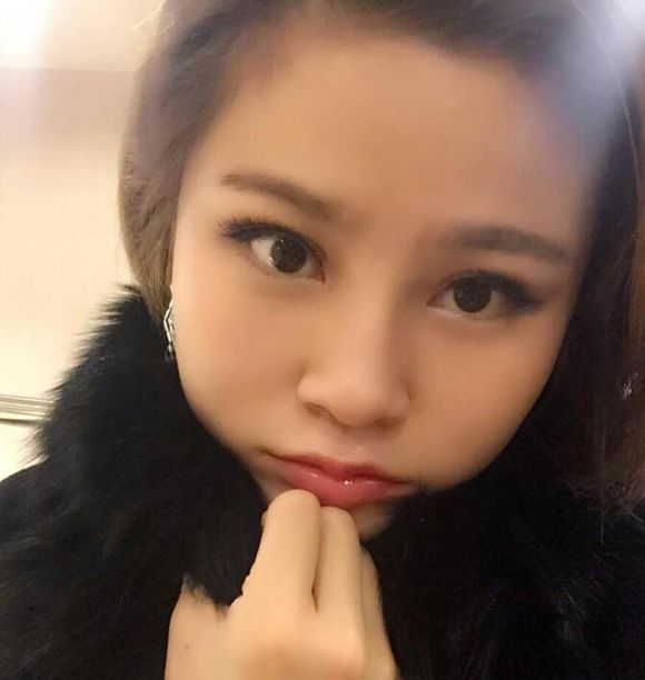 【膨体丰下巴+双眼皮手术】对比照 成功逆袭