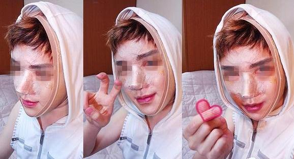 面部整形 屌丝男变男神帅帅哒 - 珍美网