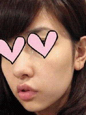 下颌角整形 自拍各个角度都很自信 - 珍美网