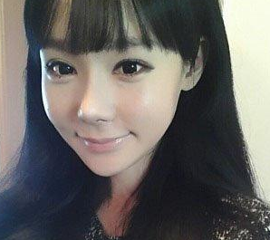 眼部整形  让自己更加美丽动人