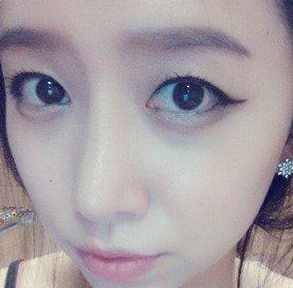 面部整形 气质的美丽立刻呈现出来