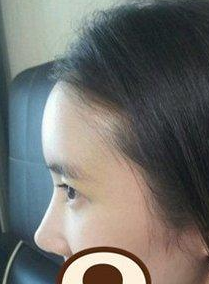 面部整形  实现不一样的自己