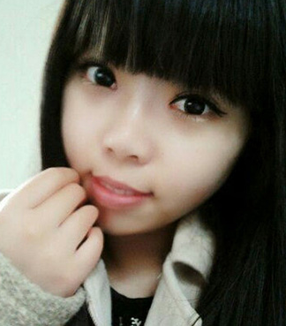 双眼皮手术 实现更加美腻的自己