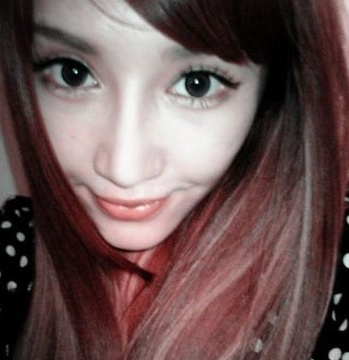 面部整形 让我更加靓丽漂亮