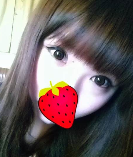 割双眼皮手术  我的眼睛更加明亮