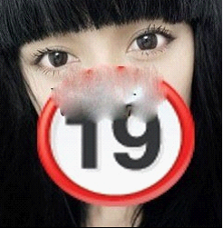 【切开法割双眼皮+开眼角】 身边的亲人朋友都说美了