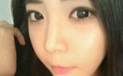 眼部整形 让我变得更加俏丽美丽