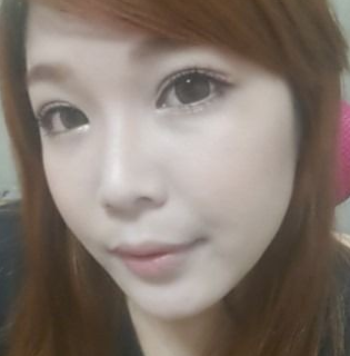 割双眼皮手术 就可以这么漂亮 - 珍美网