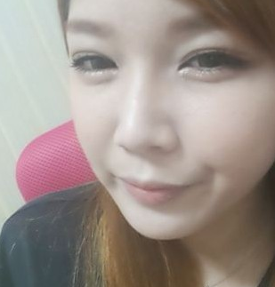 割双眼皮手术 就可以这么漂亮 - 珍美网