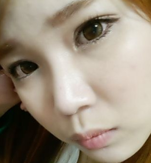 割双眼皮手术 就可以这么漂亮