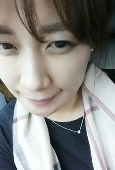 自体脂肪填充面部  美丽无暇属于我