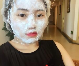 苏州工业园区瑞芙臣医疗美容诊所徐增亮医生丰全脸案例:面部填充 - 珍美网