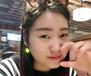 苏州工业园区瑞芙臣医疗美容诊所徐增亮医生丰全脸案例：面部填充