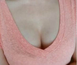 假体隆胸 让自卑滚得远远的