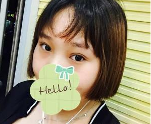 双眼皮手术 一闪一闪的大眼睛我值得拥有