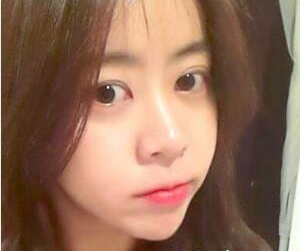 北京伟力嘉美信医疗美容门诊部马永奇医生丰全脸案例：成就我的美