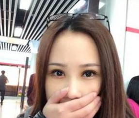 双眼皮手术 眼睛更加迷人好看