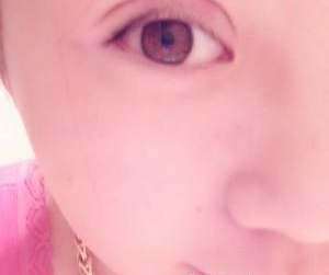 双眼皮手术 提升自身美丽很重要