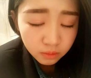 割双眼皮  脱单不是问题美的不要不要的