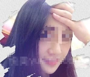 玻尿酸丰下巴 全新的我真好看