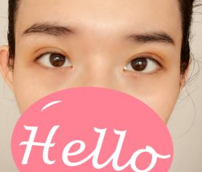 双眼皮手术 看着镜里的自己好看的差点爱上自己 - 珍美网