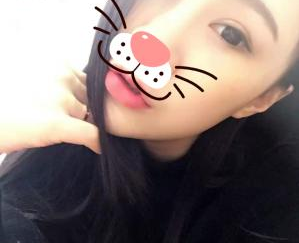 割双眼手术  原来大眼睛这么神奇 美美哒