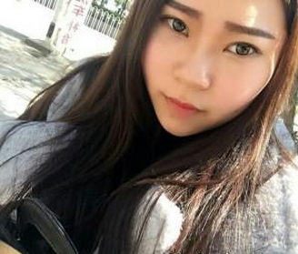 玻尿酸隆鼻  提升气质让我非常开心